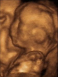 Ecografía 3D de un feto de 20 semanas.