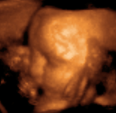 Ecografía en 3D de un feto de 29 semanas.